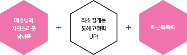 매몰법의 자연스러운 쌍꺼풀, 최소 절개를 통해 고정력 UP 빠른 회복력