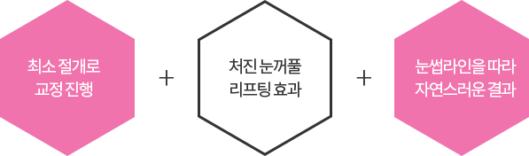 최소 절개를 통한 고정 눈꺼풀 리프팅 효과 인위적이지 않은 자연스러운 눈매